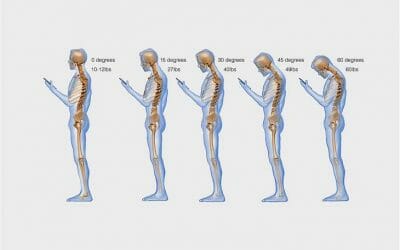 How Your Smartphone Is Damaging Your Spine And Hands