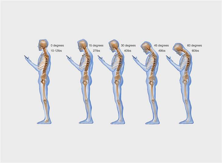 How Your Smartphone Is Damaging Your Spine And Hands